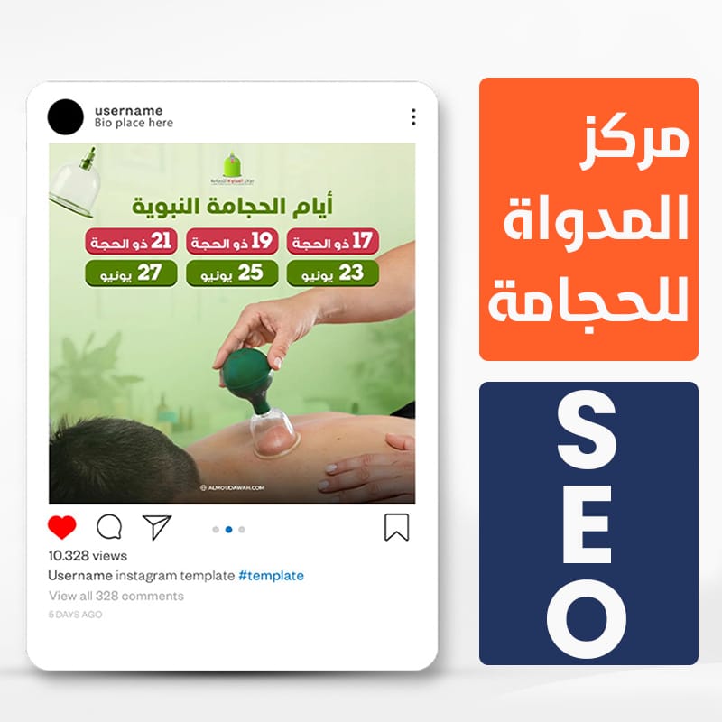 تحسين محركات البحث لمراكز الحجامة